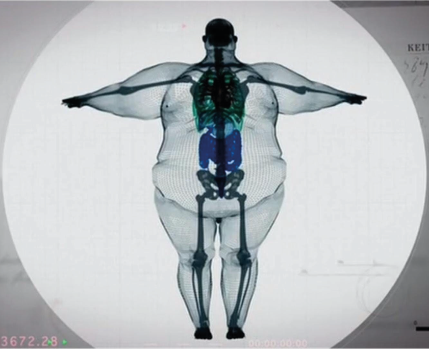 You're absolutely NOT big boned. It's Not An Excuse For Being Overweight